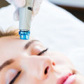 Hydrating Facials: What You Need to Know